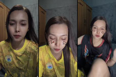 สิว