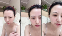 十分钟进冰箱脸肿打了针的