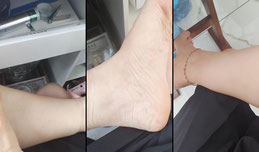 听说都排队去她家做熏蒸