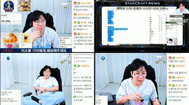 수술대 이모저모