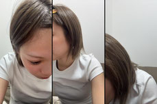 扁桃腺除去した人詳しく教えて~