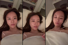 수술해서 얼굴 부움