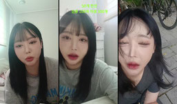 부었어요...