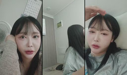 부었어요...