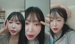 부었어요...