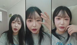 부었어요...