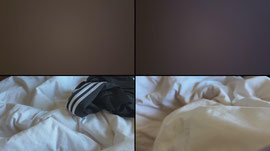 入院中の普通のおねえさん