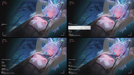 Recording Thumbnail