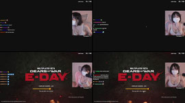 LIVE🔴 E-DAY WOOHOOO🔴  / Hair Implant = Mask