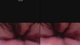 buthole